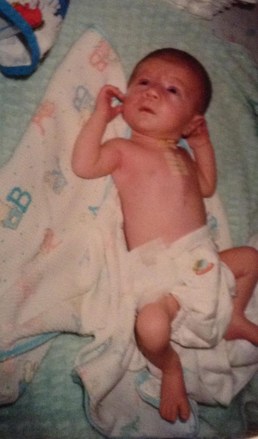 Theatre senior Aidan Renda is pictured after his first open heart surgery at 10-days-old. Renda was born without his left ventricle.